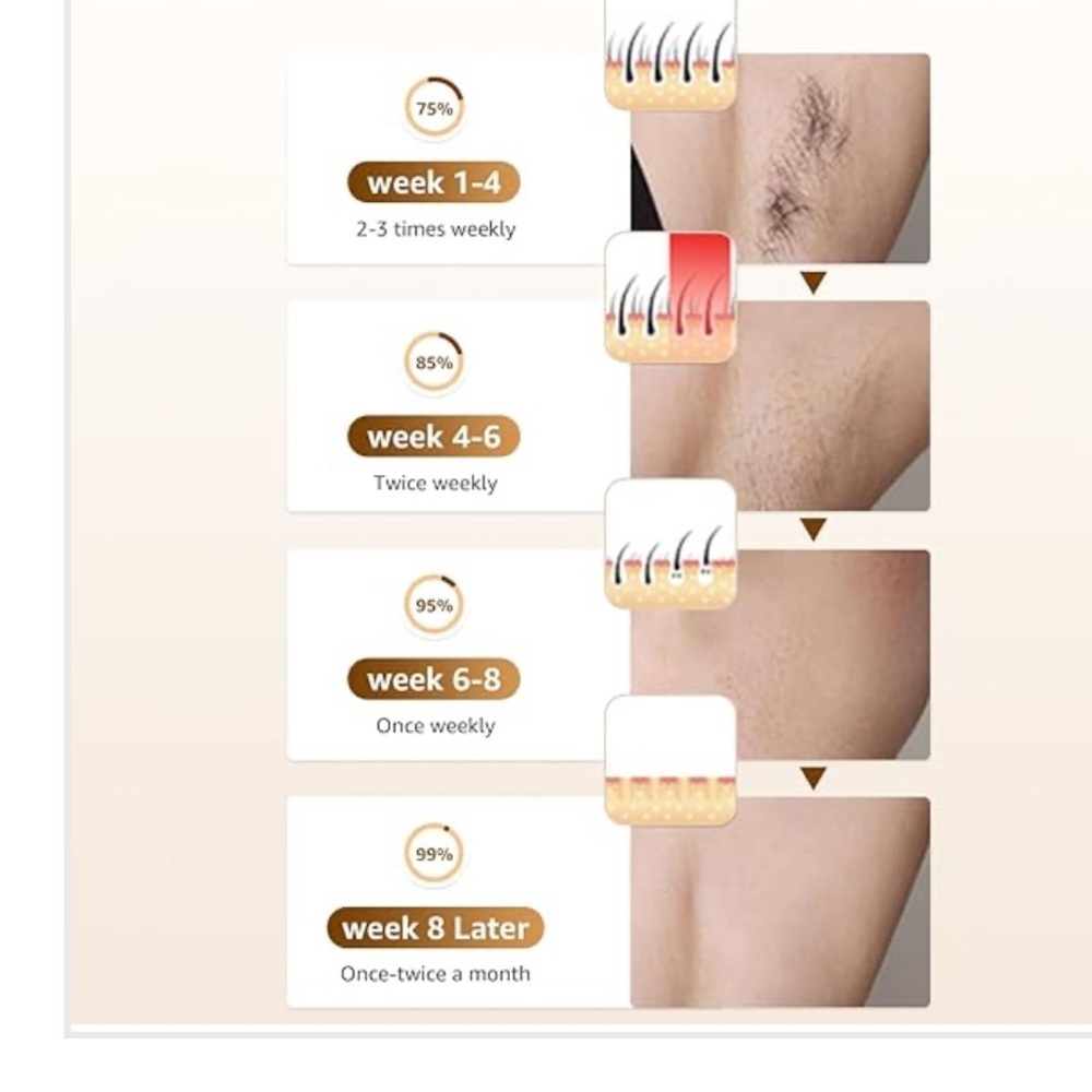 Rodzon IPL Hair Removal Device (059) - Picture 2 of 3